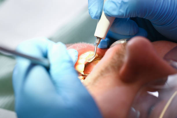 Best Root Canal Emergency Dentist  in Mount Pleasant, MI