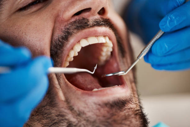 Best Chipped Tooth Repair Near Me  in Mount Pleasant, MI